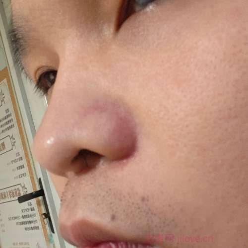 30岁岁江苏单身帅哥 - 六盘水吉缘网